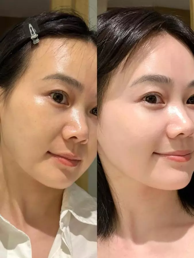 Sự Khác Biệt Giữa Cấp Ẩm và Cấp Nước Cho Làn Da: Bạn Thực Sự Cần Gì?