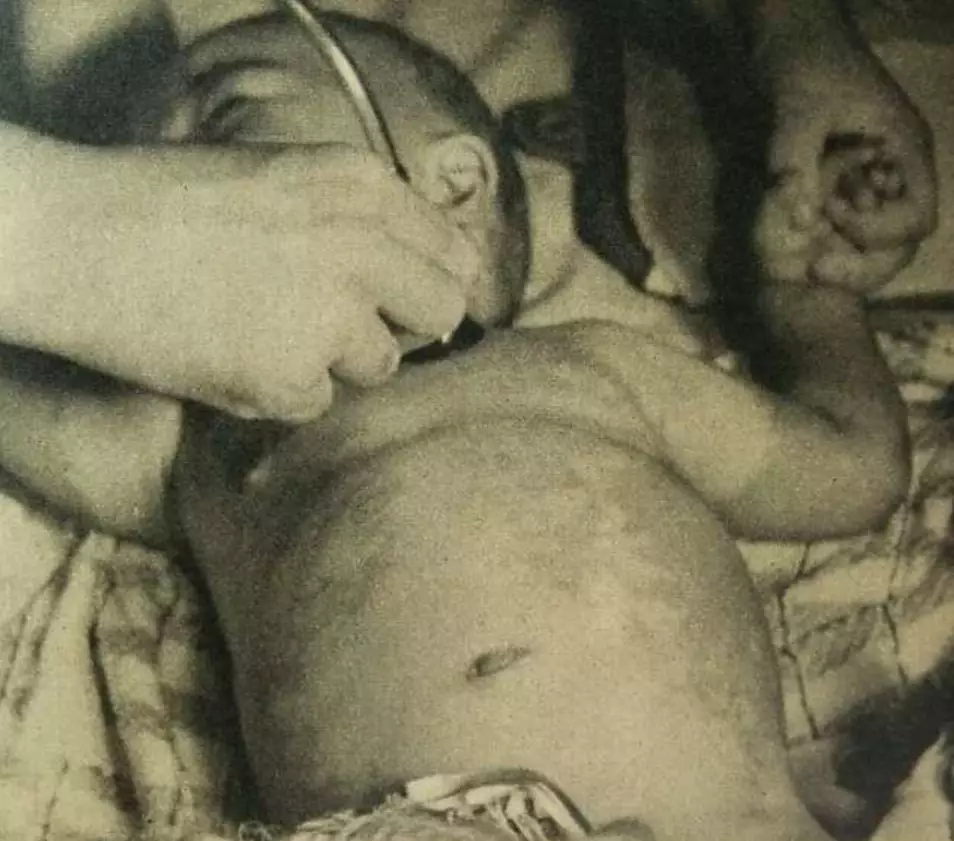 Thảm họa sữa nhiễm thạch tín 1955 tại Nhật Bản