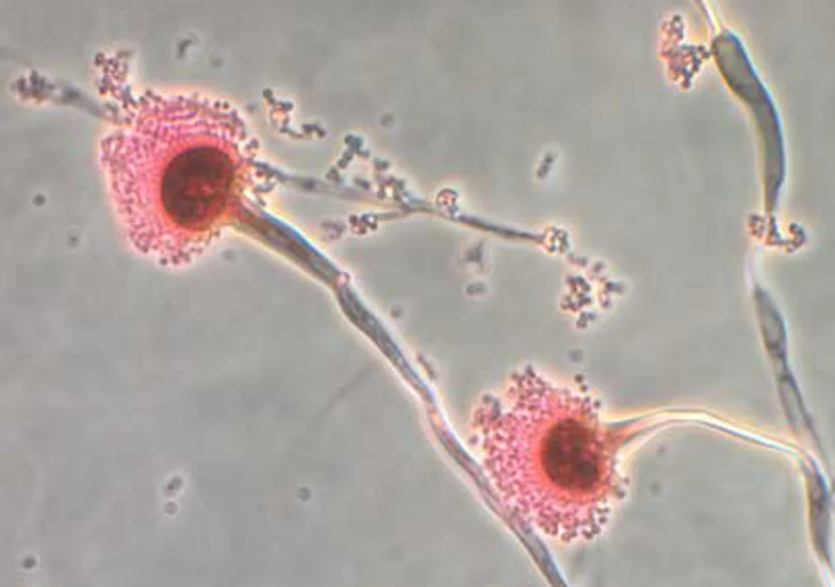 nấm Aspergillus