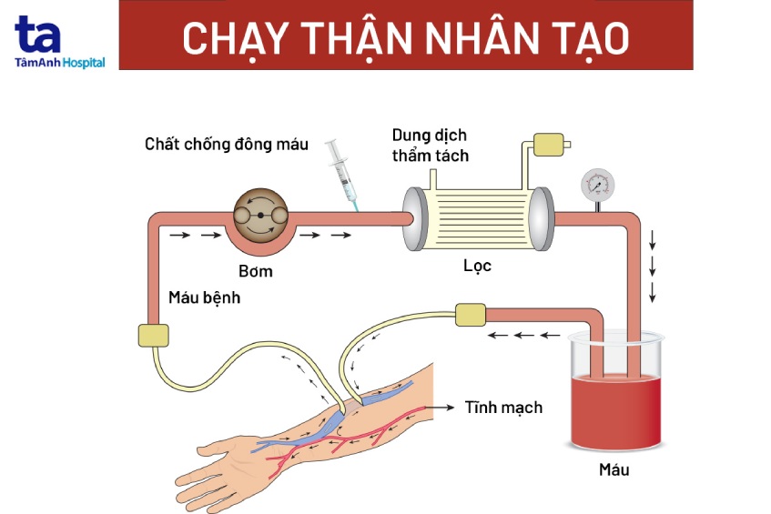 Chàng trai 30 tuổi suy thận giai đoạn cuối vì bỏ qua dấu hiệu cảnh báo - Hình ảnh minh họa