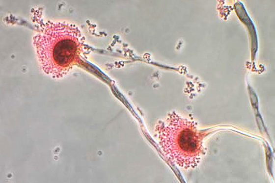 Nấm Aspergillus fumigatus kháng thuốc gia tăng, đe dọa điều trị toàn cầu - Hình ảnh minh họa