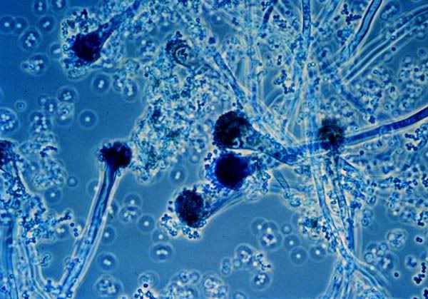 Nấm Aspergillus fumigatus kháng thuốc gia tăng, đe dọa điều trị toàn cầu - Hình ảnh minh họa